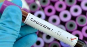 Coronavirus, drastico calo dei contagi in città: sono 57 i positivi accertati