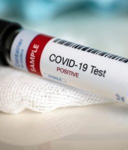 Coronavirus
 


morto 
 


un 78enne
 


a Cerveteri