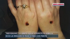 “Le stimmate di Gisella Cardia sono straordinarie”, parla la dottoressa della veggente di Trevignano Romano