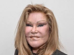 È morta Jocelyn Wildenstein: la “donna gatto” aveva 84 anni